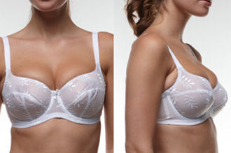 Cup size is too small if the breast bulges over or you have to adjust the bra several times during a day.